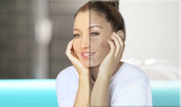 emove Dark Spots on Face Tan for Clear Looking Skin